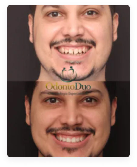 Rectangle 181